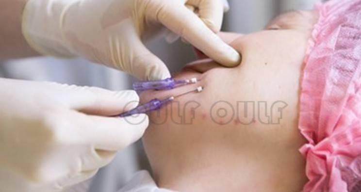 線雕最新手法，背景、發(fā)展、時(shí)代地位及展望